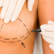 Illustration for article titled FDA Warned About Dangers Of French Breast Implants, But No One Listened
